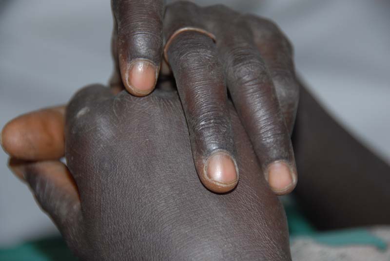 burkina faso - 2007- 0111