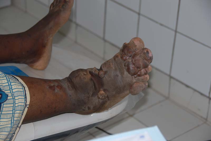 Burkina Faso - Natale 2007- gennaio 2008 - progetto ouatara - foto0724